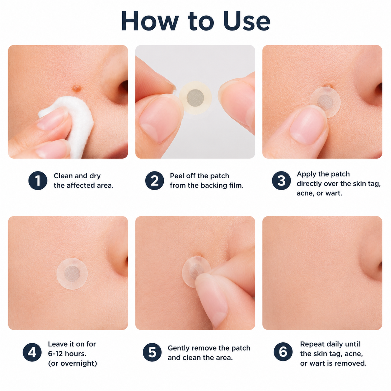 ✨✨𝐌𝗢𝑷𝙍𝙊® 2-in-1 Microneedle & Hydrocolloid Patch🌈| Removes Raised Moles, Acne, Flat Warts & Skin Tags | Helps Improve Wrinkles, Scars & Blemishes | Invisible Patches for Face & Body