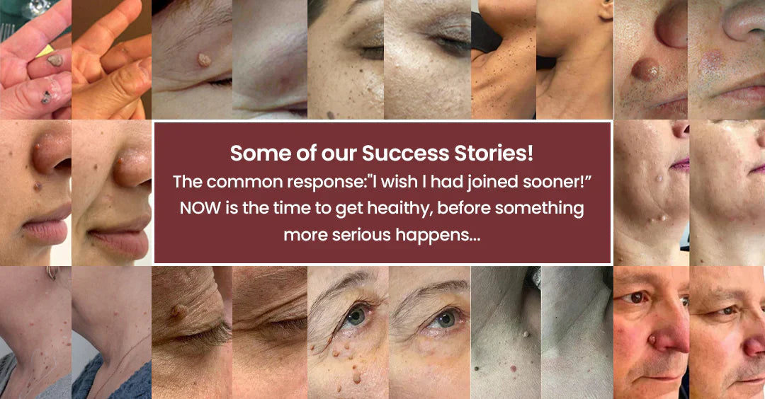 ✨✨𝐌𝗢𝑷𝙍𝙊® 2-in-1 Microneedle & Hydrocolloid Patch🌈| Removes Raised Moles, Acne, Flat Warts & Skin Tags | Helps Improve Wrinkles, Scars & Blemishes | Invisible Patches for Face & Body