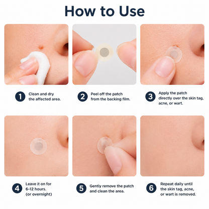 ✅🇺🇸𝐇𝐞𝒂𝒍𝗿𝗶𝙯𝙚®2-in-1 Microneedle & Hydrocolloid Patch🛡️| Removes Raised Moles, Acne, Flat Warts & Skin Tags | Helps Improve Wrinkles, Scars & Blemishes | Invisible Patches for Face & Body